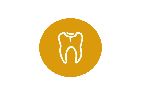 Dental Sealants