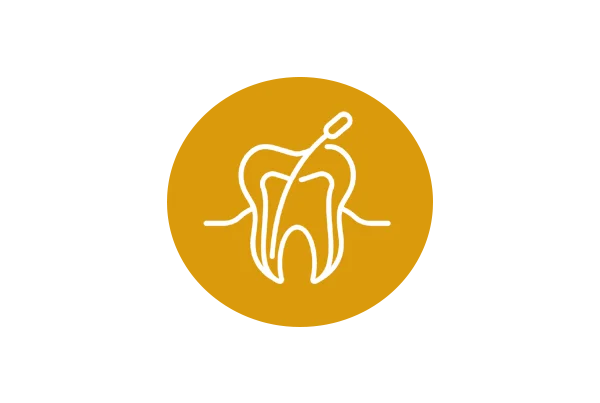 Root Canal Treatment