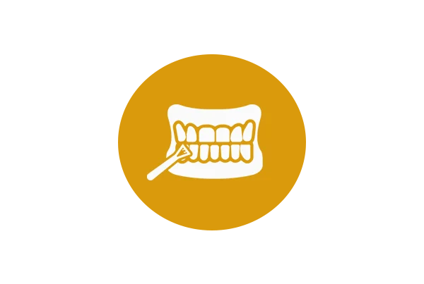Fluoride Therapy